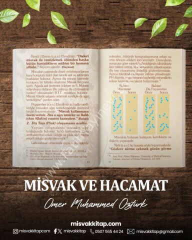 Sağlıklı Yaşam Için Vazgeçilmeyecek Iki Sünnet Misvak Ve Hacamat (CEP BOY)